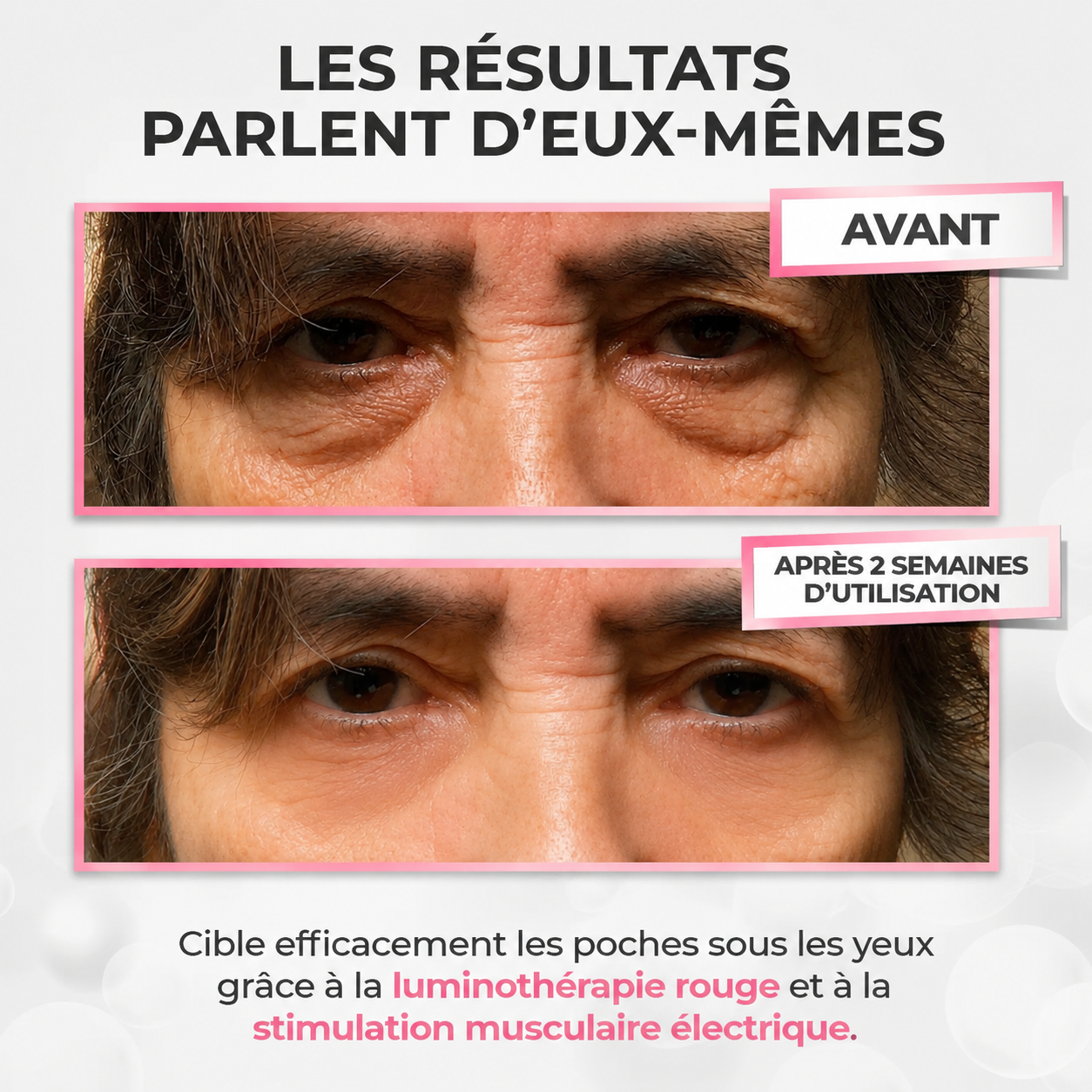 LumiLift™ 2-en-1 | Anti-cernes & Anti-poches