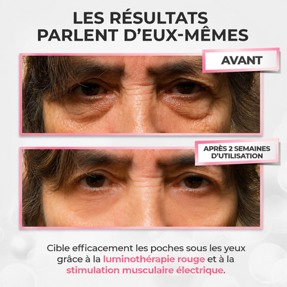 LumiLift™ 2-en-1 | Anti-cernes & Anti-poches
