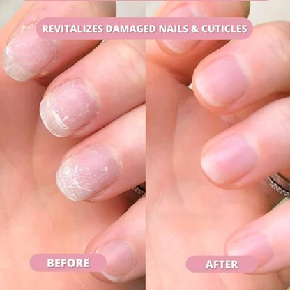 Stylo RenovOngle aux Cellules Souches