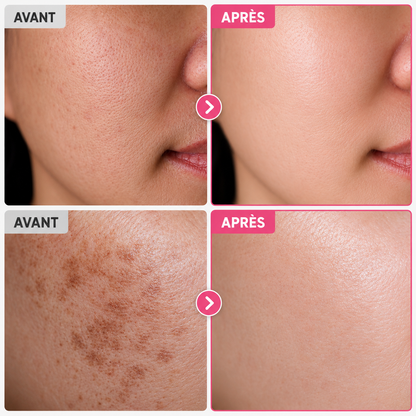 Crème Éclat Anti-Taches Coréenne