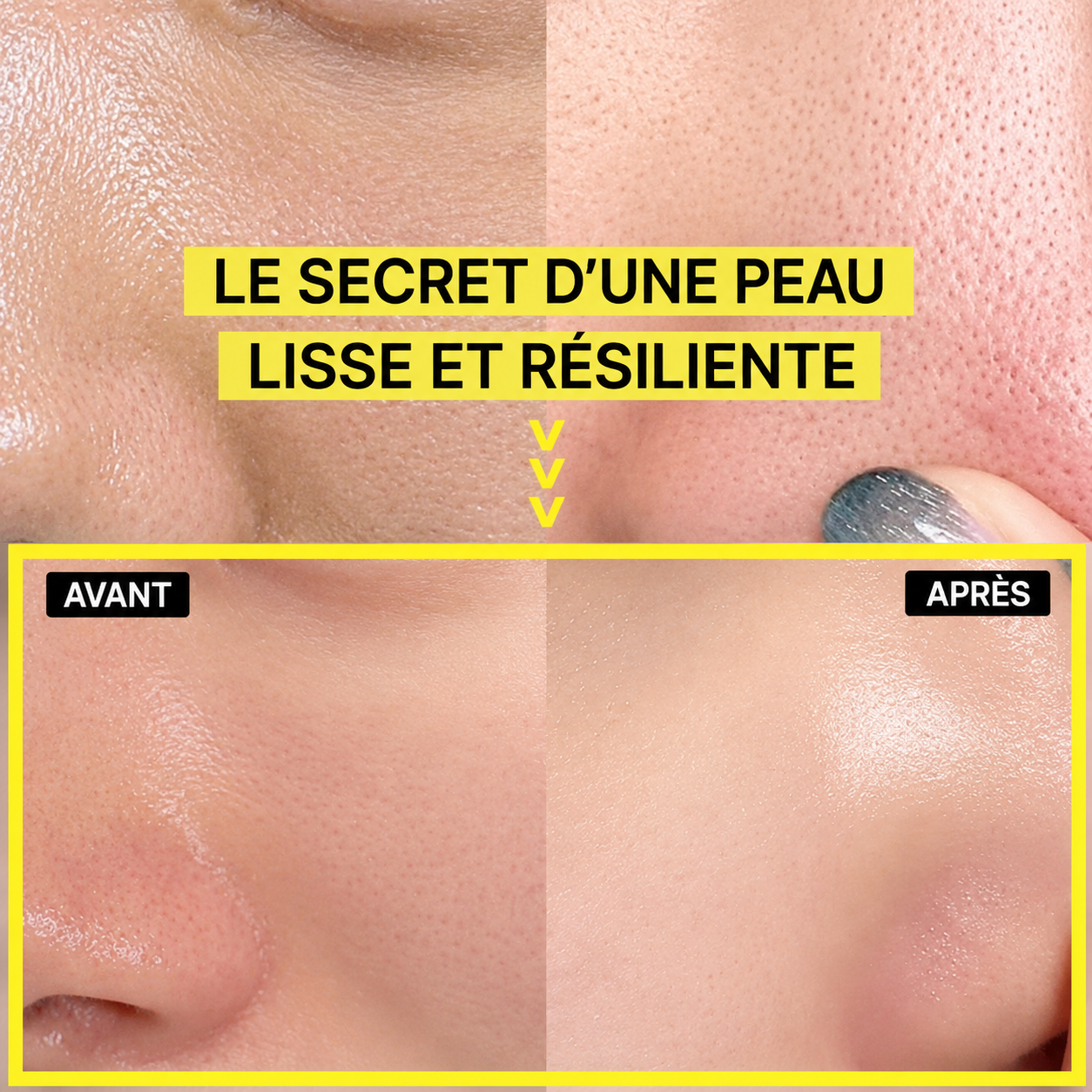 Rétinéa™ — Peau visiblement raffermie