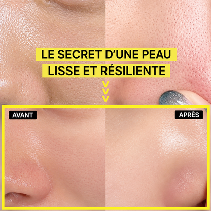 Rétinéa™ — Peau visiblement raffermie