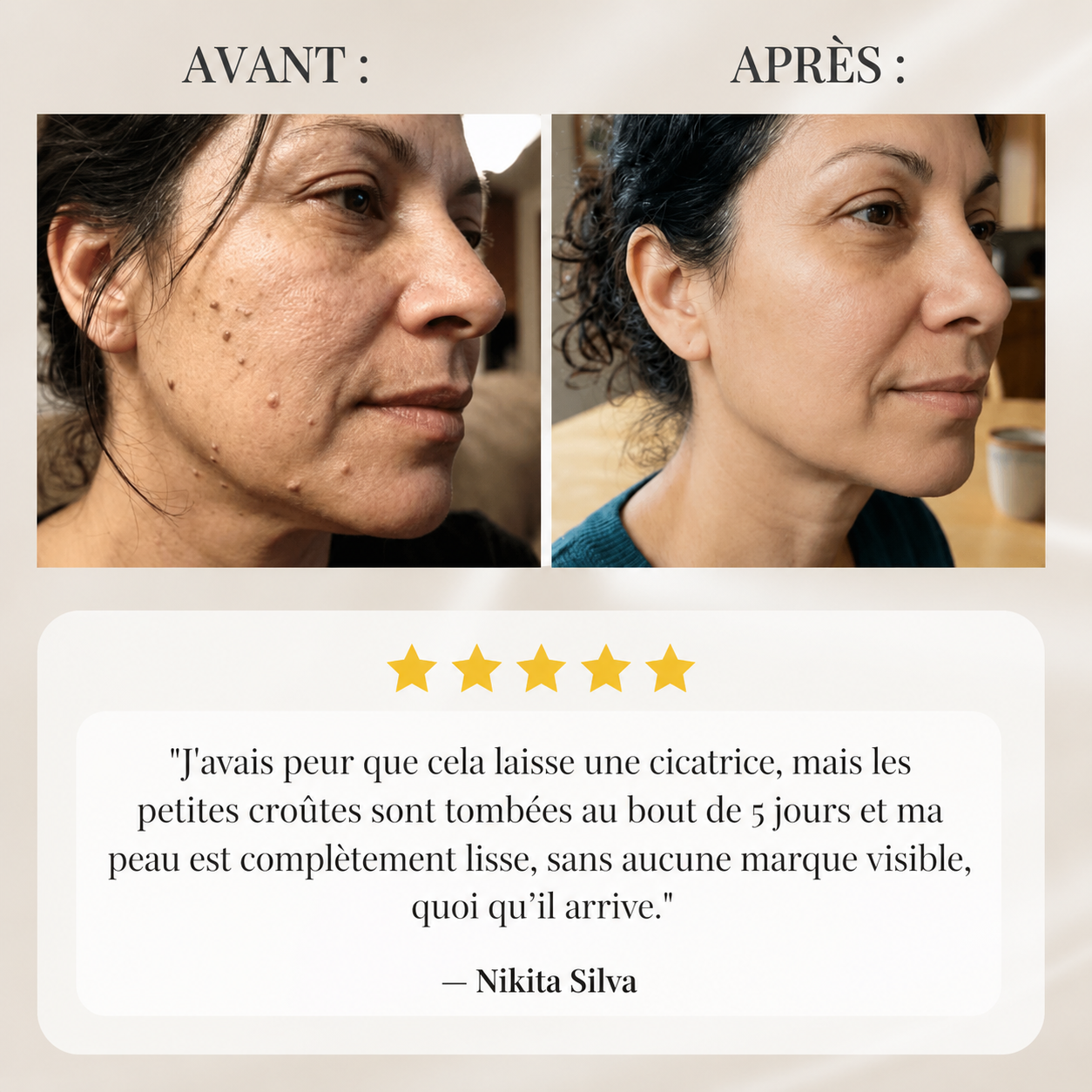 Nettéa™ — Le stylo qui affine visiblement le grain de peau