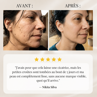Nettéa™ — Le stylo qui affine visiblement le grain de peau
