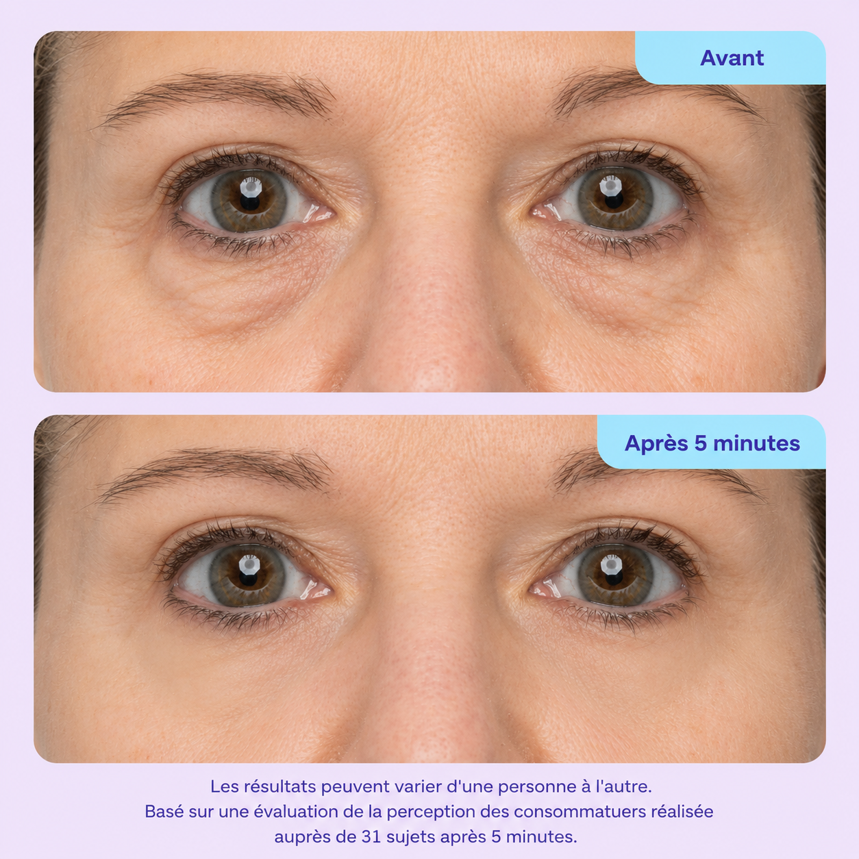 Gel Liftant Instantané — Contour des Yeux