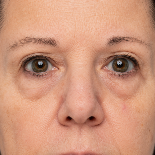 Nathalie B., 52 ans