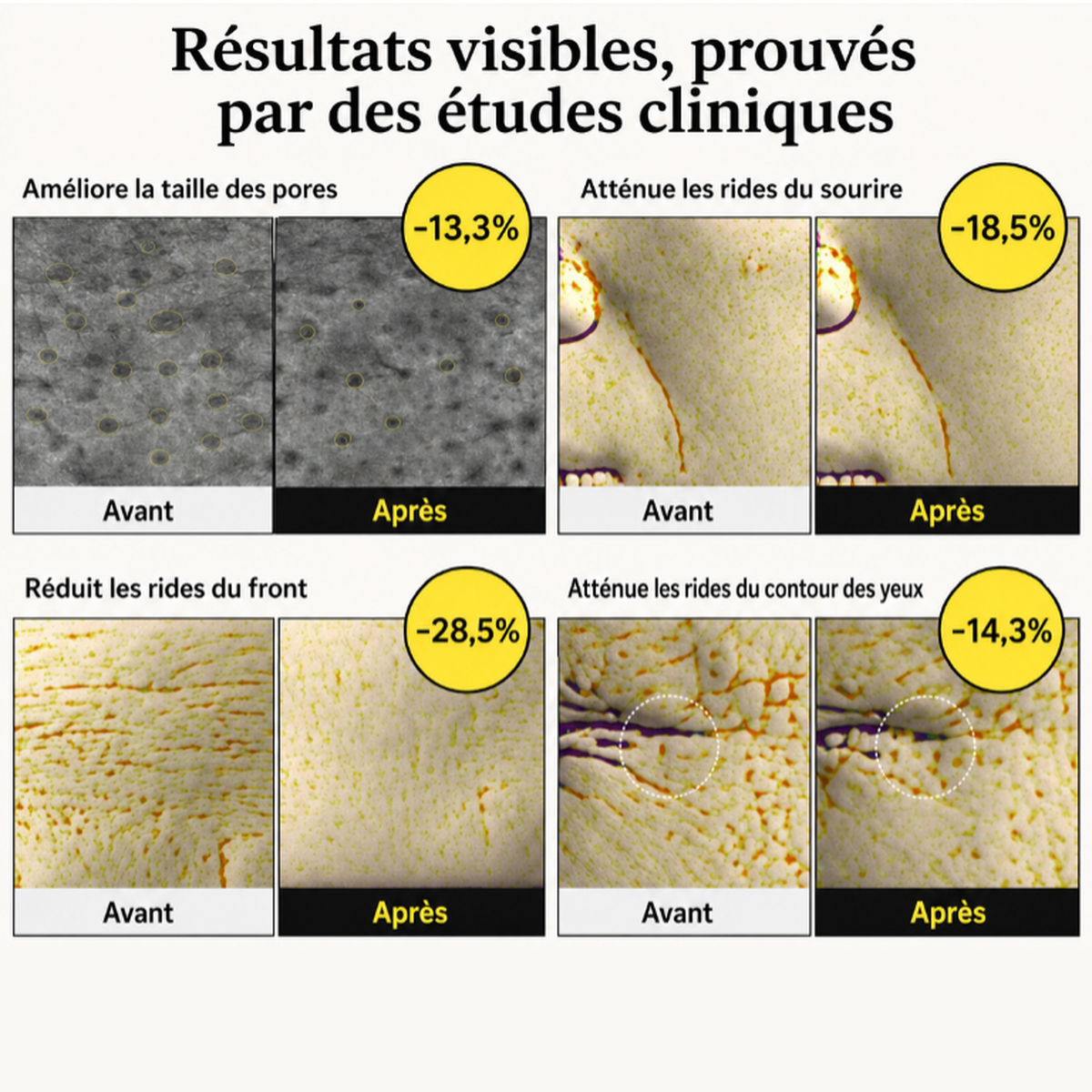 Rétinéa™ — Peau visiblement raffermie