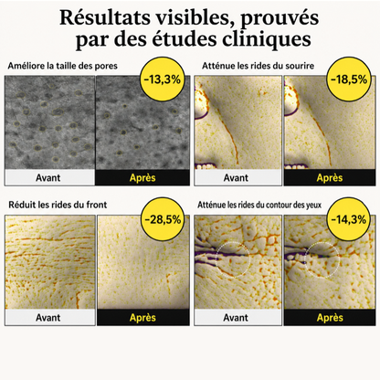 Rétinéa™ — Peau visiblement raffermie